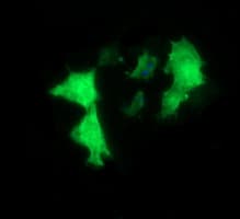 MYBPH Antibody (clone OTI3G1)