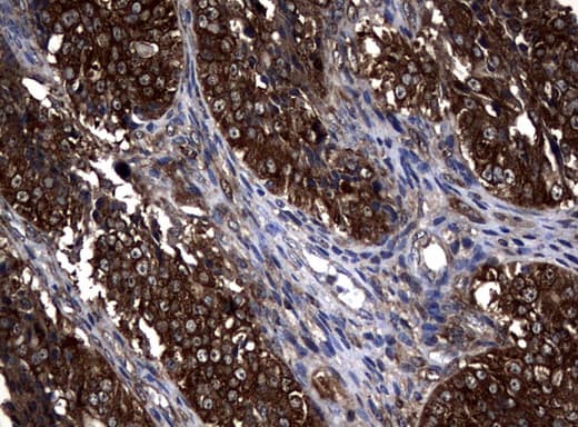 Monoclonal Mouse anti-Human NME1 / NM23 Antibody (clone UMAB93, IHC, IF, WB)