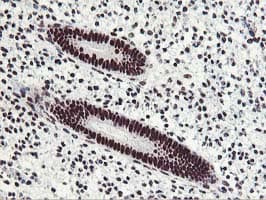 HOXC11 Antibody (aa1-304, clone OTI3E10, Carrier-free)