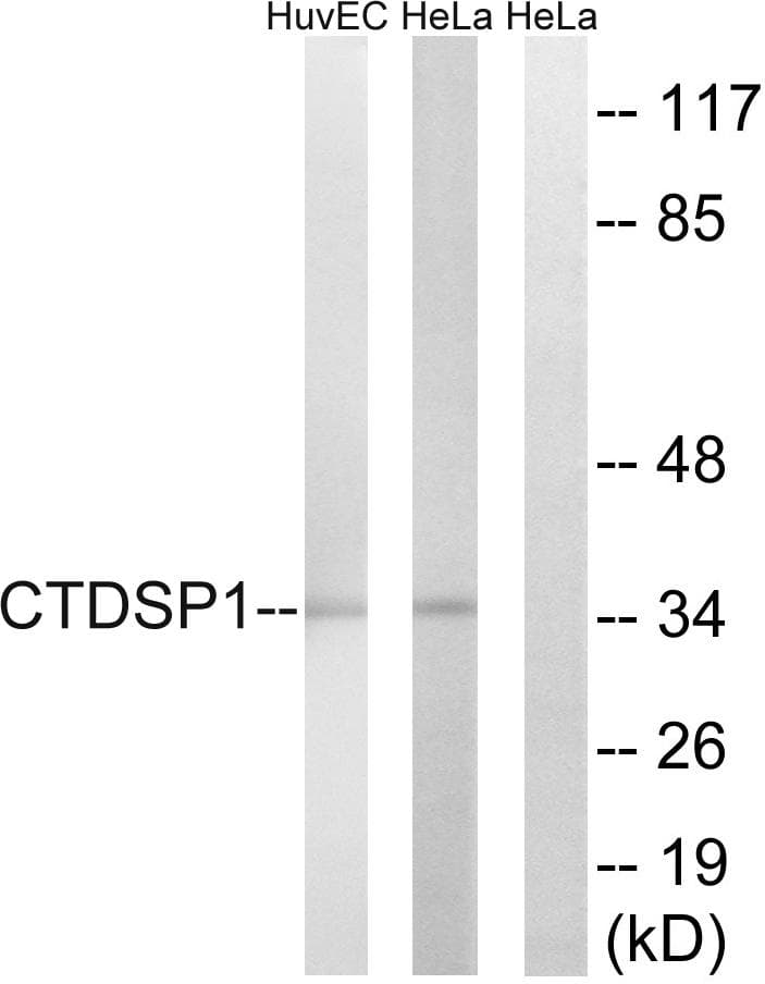 Polyclonal Rabbit anti-Human CTDSP1 / SCP1 Antibody (IHC, WB)