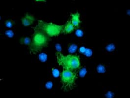 SMS / Spermine Synthase Antibody (clone OTI1G7)