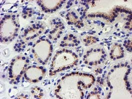 KCNAB1 Antibody (clone OTI9F7)