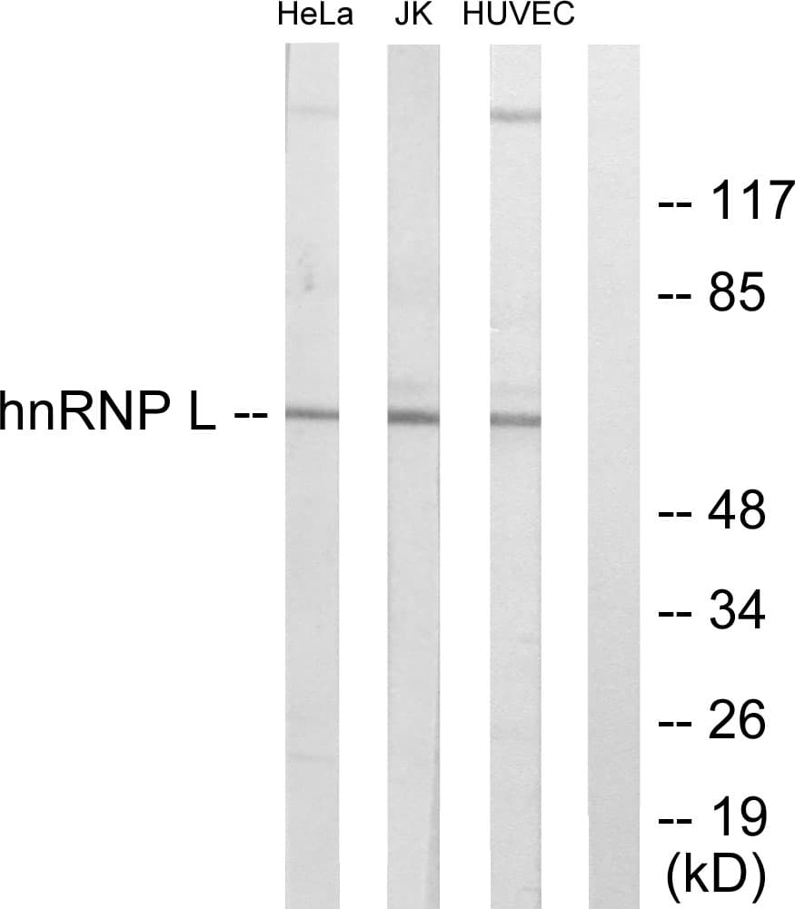 IHC-plus™ HNRNPL / hnRNP L Antibody (aa61-110)
