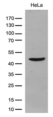 Monoclonal Mouse anti-Human GIPC1 / GIPC Antibody (clone OTI4C11, WB)