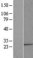 Human ALG14 Protein (Over-Expression Lysate Myc-DDK (Flag))