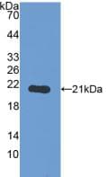 PYGL Antibody (aa370-538, Biotin)