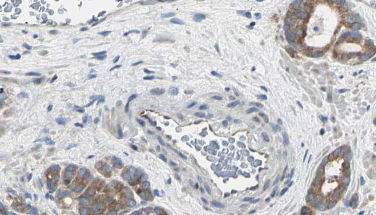 Polyclonal Rabbit anti-Human AGBL2 / CCP2 Antibody (IHC, IF, WB)