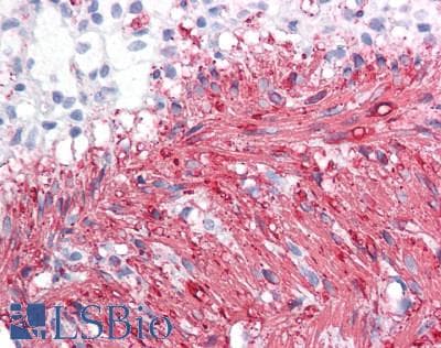 TPM2 Antibody (aa1-284)