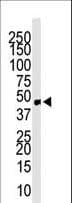 ACKR2 / CCR10 / D6 Antibody (aa298-328)