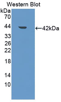 ARH / LDLRAP1 Antibody (aa1-308)