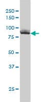 XRCC5 / Ku80 Antibody (clone 3D8)