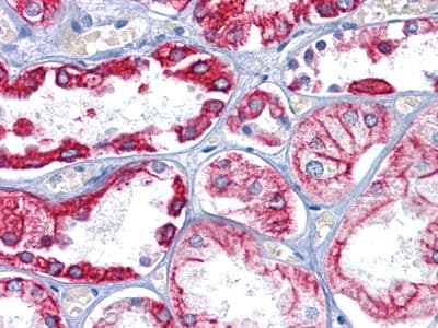 KRT8 / CK8 / Cytokeratin 8 Antibody (Amino Acid: 391-483, clone 8A5D12)