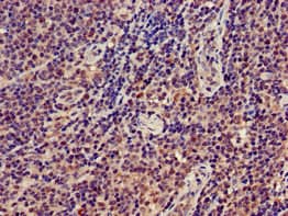 GRAP2 / GRID Antibody