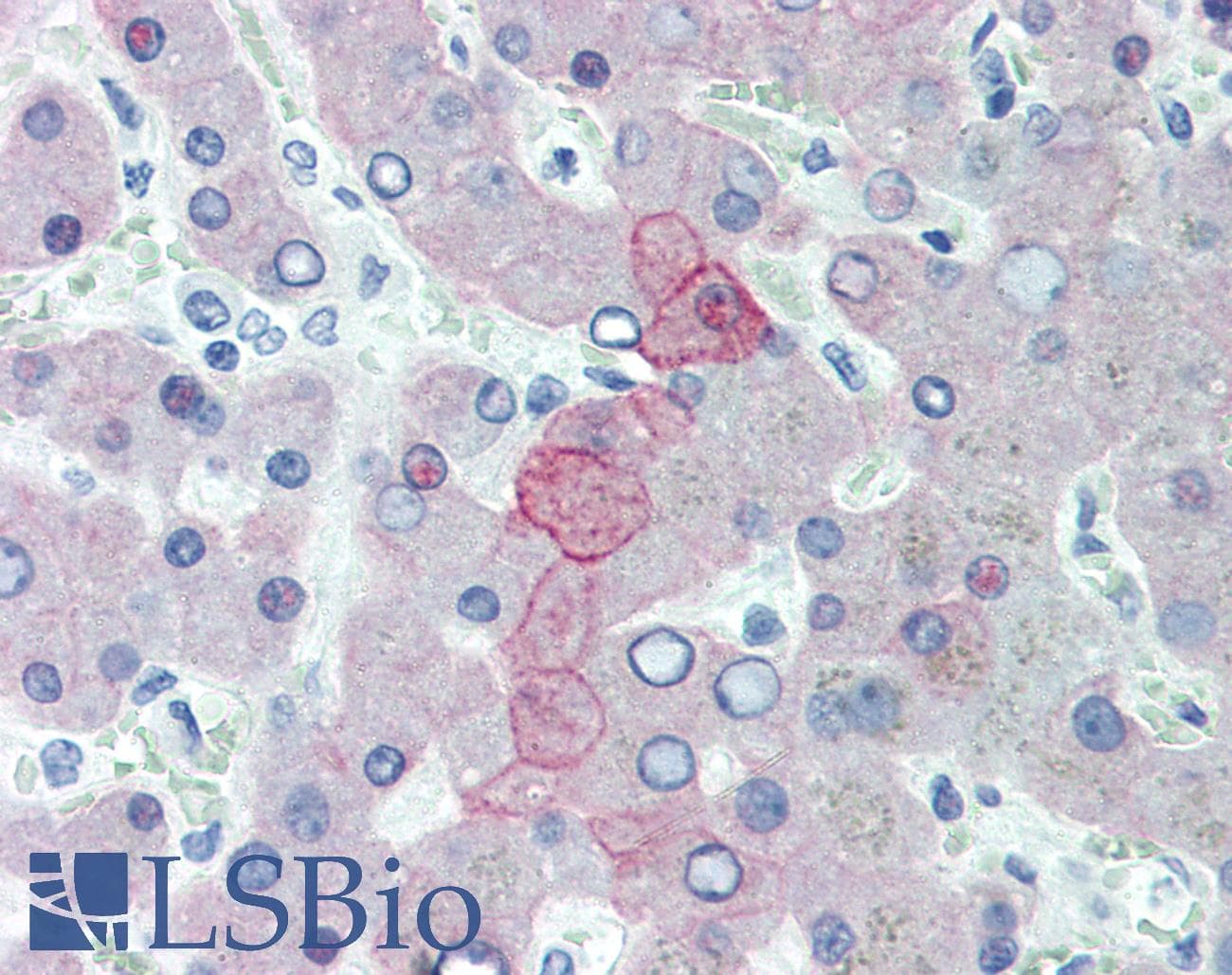 IHC-plus™ KRT8 / CK8 / Cytokeratin 8 Antibody (C-Terminus, clone R15-K)