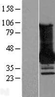 MAGEA4 Protein (Over-Expression Lysate Myc-DDK (Flag))