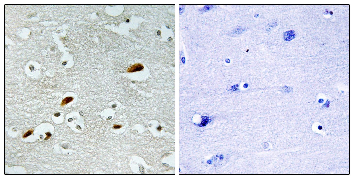 KAT5 / TIP60 Antibody (aa371-420)