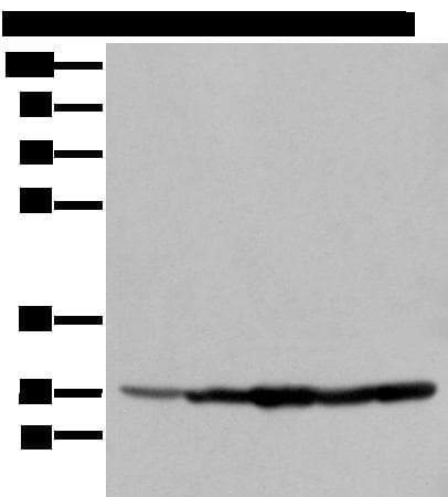 ECI1 / DCI Antibody