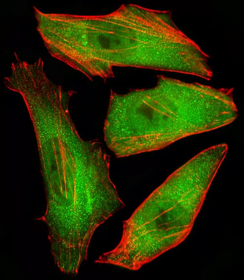 Polyclonal Rabbit anti-Human CFL2 / Cofilin 2 Antibody (aa130-144, IF, WB)