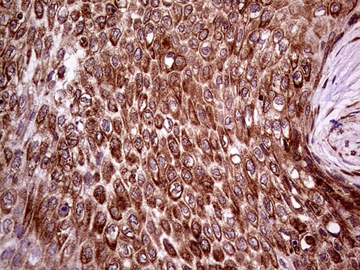 Monoclonal Mouse anti-Human ERLIN1 / SPFH1 Antibody (clone OTI4B1, aa107-346, IHC, WB)