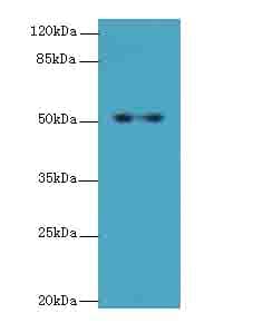 Polyclonal Rabbit anti-Human C4orf37 Antibody (IHC, WB)
