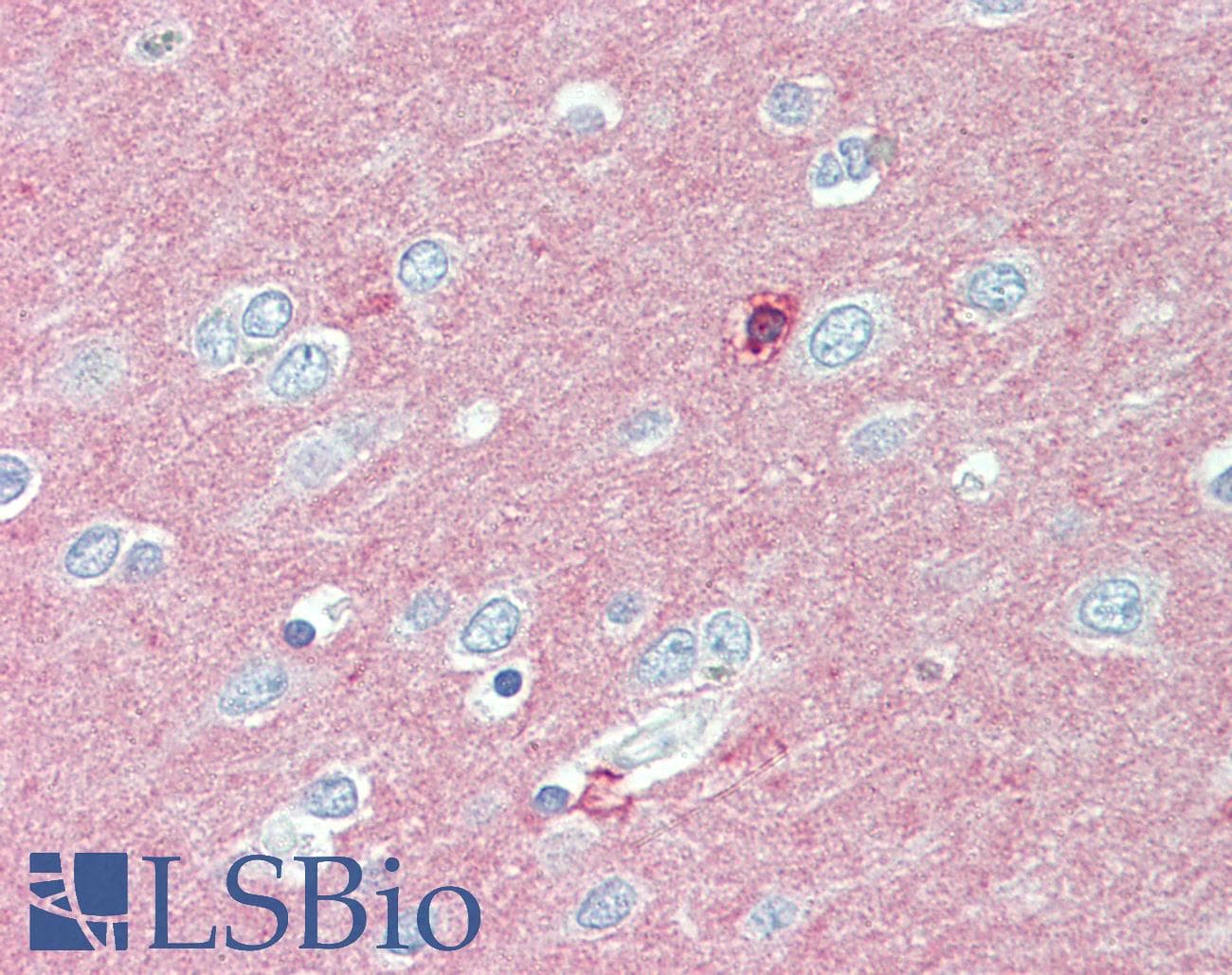 IHC-plus™ Polyclonal Rabbit anti-Human CADM2 Antibody (Internal, IHC)