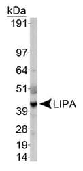 IHC-plus™ LIPA / Lysosomal Acid Lipase Antibody (aa150-300)
