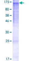 Human HPS5 Protein (Recombinant GST)