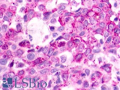 PathPlus™ GPR183 / EBI2 Antibody (Cytoplasmic Domain)