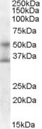 IHC-plus™ FOXA1 Antibody (aa429-439)