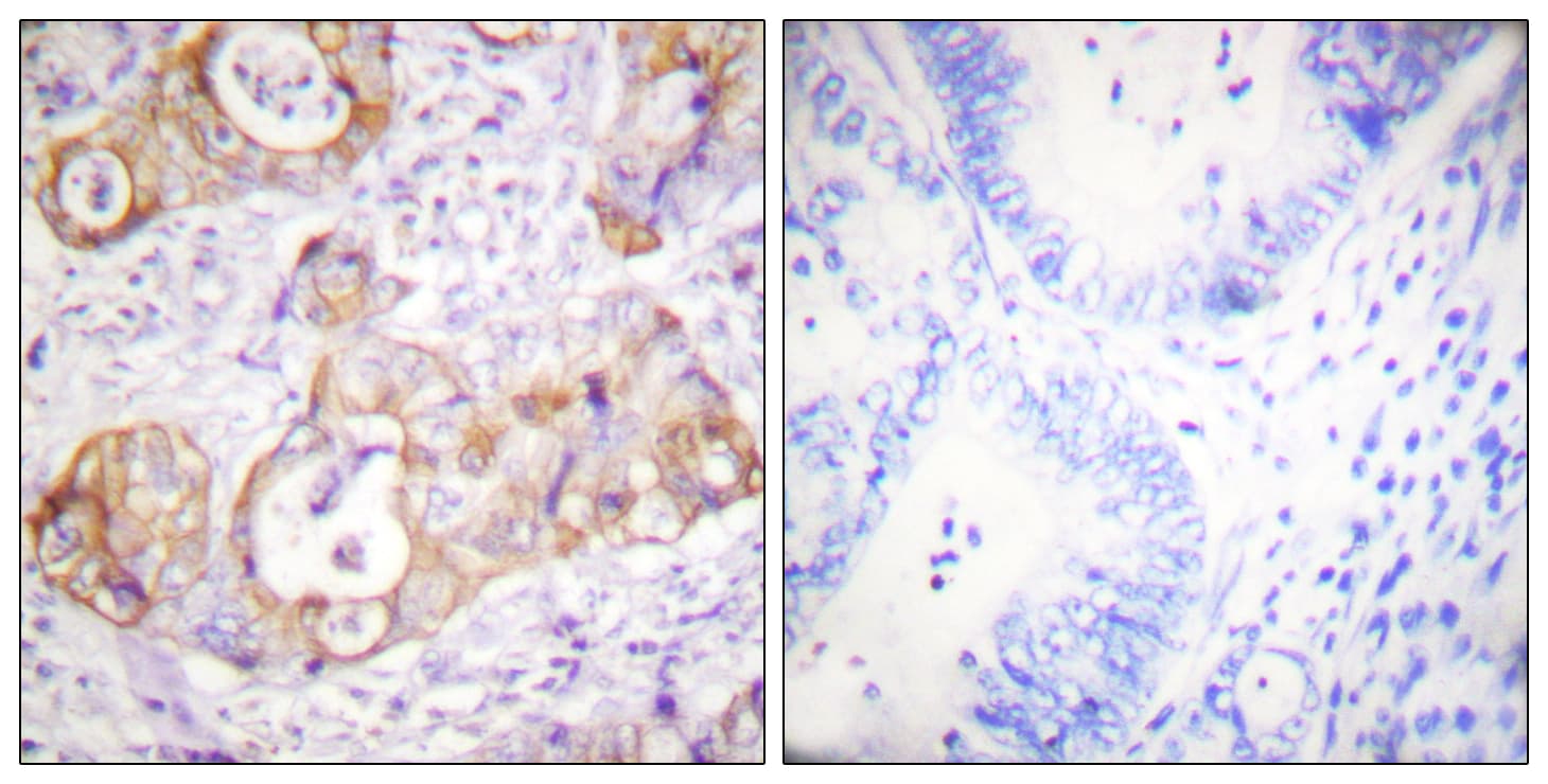 Polyclonal Rabbit anti-Human KRT8 / CK8 / Cytokeratin 8 Antibody (phospho-Ser432, IHC, IF, WB)