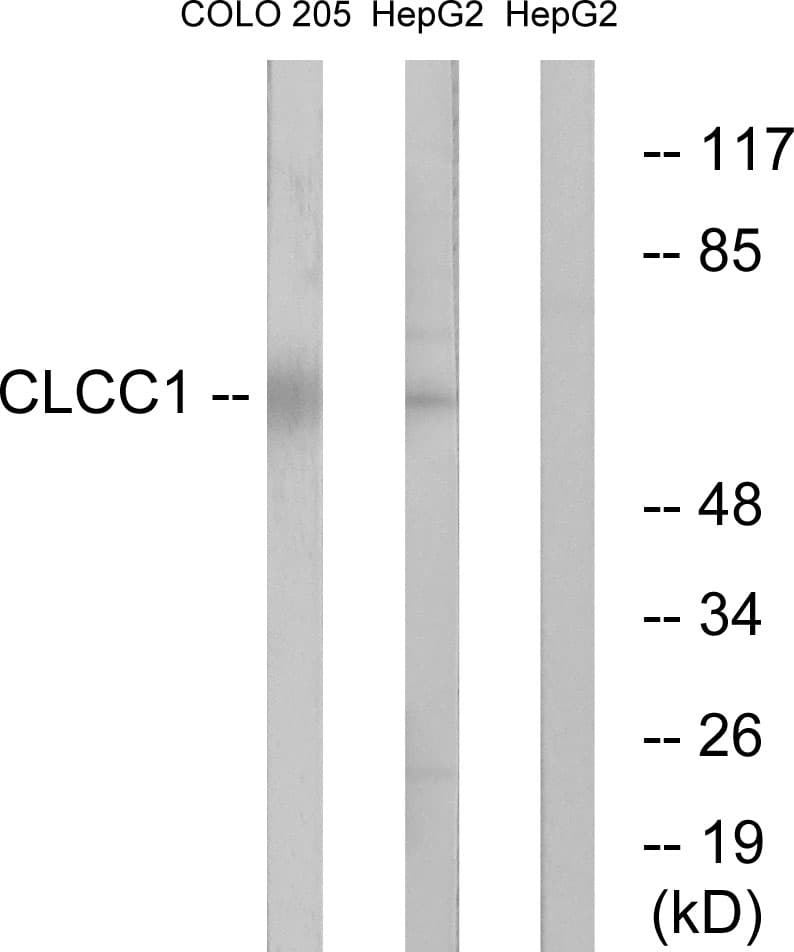 CLCC1 Antibody (aa391-440)