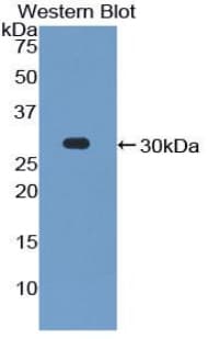 PCDH1 / PCD1 Antibody (aa575-812, Biotin)