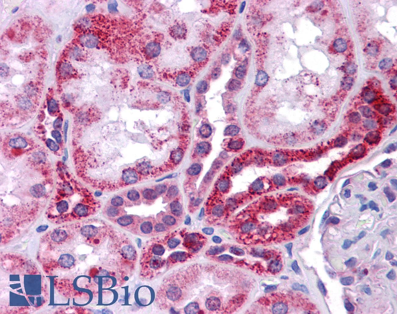 Polyclonal Rabbit anti-Human TP53 / p53 Antibody (N-Terminus, IHC, WB)