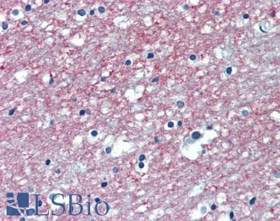 PD-L2 / PDCD1LG2 / CD273 Antibody (aa36-219)