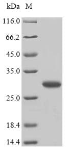 Dermatophagoides pteronyssinus ELP5 Protein (Recombinant GST, N-terminus)