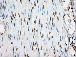 Monoclonal Mouse anti-Human ACSBG1 / hsBG Antibody (clone OTI1D8, IHC, IF, WB)