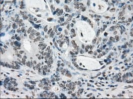 PRKY Antibody (clone OTI6H3, Carrier-free)