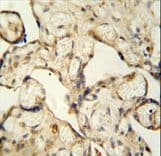 LCA5L Antibody (aa380-408)