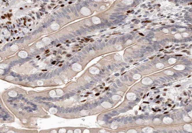 SCGB2A1 / Mammaglobin B Antibody