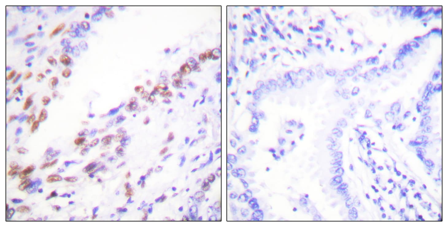 Polyclonal Rabbit anti-Human MKI67 / Ki67 Antibody (aa3207-3256, IHC, IF)