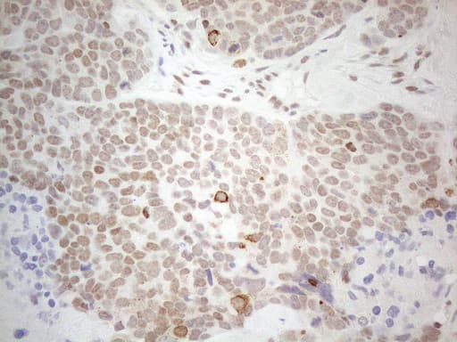 GATA3 Antibody (aa155-443, clone OTI10G7)