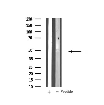 Polyclonal Rabbit anti-Human ZFYVE19 Antibody (IHC, IF, WB)