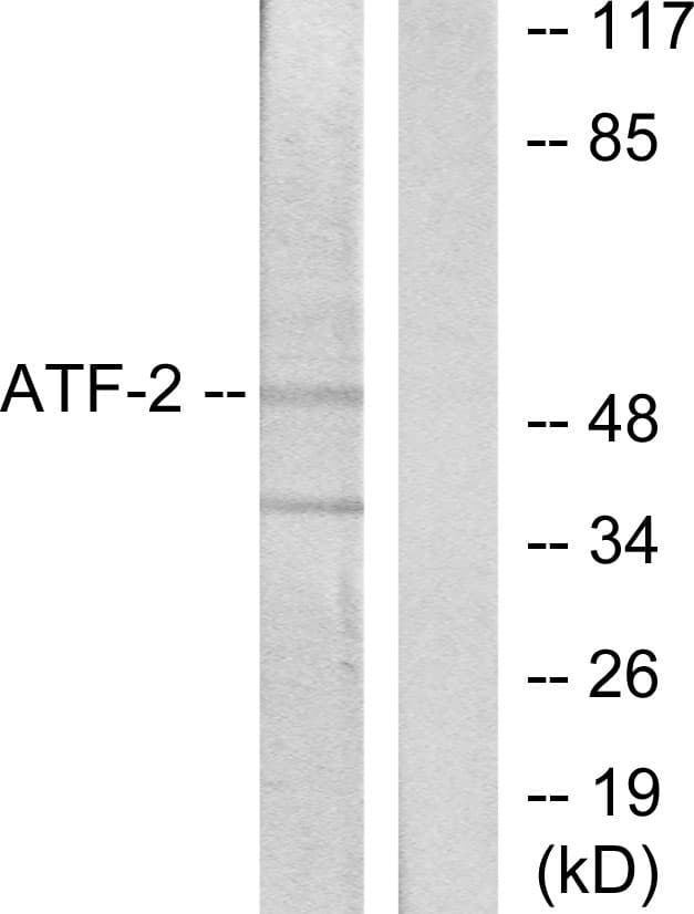 ATF2 Antibody (aa29-78)