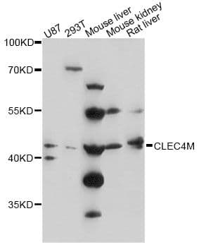 CLEC4M / L-SIGN / CD299 Antibody