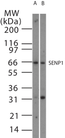 SENP1 Antibody (aa578-590)