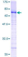 Human ZNF191 / ZNF24 Protein (Recombinant GST)