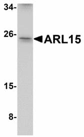 IHC-plus™ Polyclonal Rabbit anti-Human ARL15 Antibody (IHC, WB)