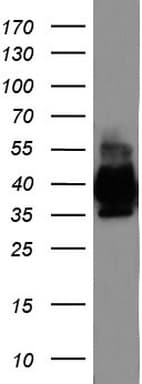 Monoclonal Mouse anti-Human EPCAM Antibody (clone UMAB131, IHC, WB)