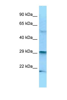 BAK1 / BAK Antibody (N-Terminus)