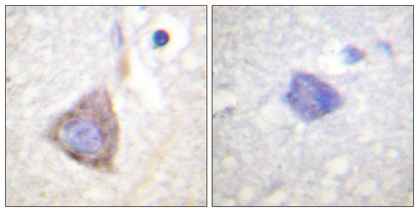CML / BCR Antibody